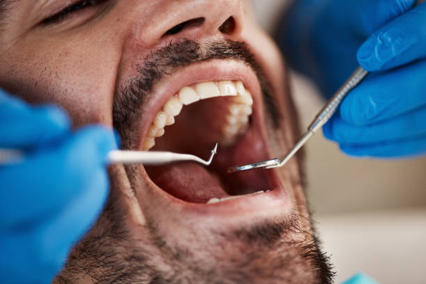 Best Emergency Treatment for Dental Infections or Abscesses in Quanah, TX
