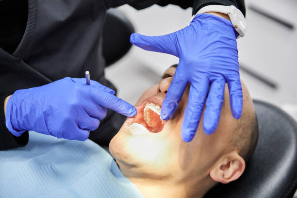 Best Emergency Gum Treatment in Quanah, TX